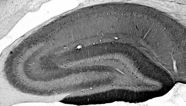 Neuroligin-3 Antibody in Immunohistochemistry (Frozen) (IHC (F))
