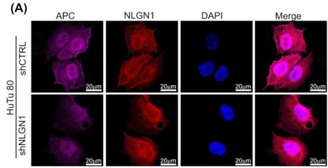 Neuroligin-1 Antibody in Immunocytochemistry (ICC/IF)