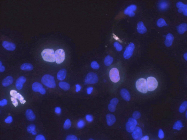 Haspin/GSG2 Antibody in Immunocytochemistry (ICC/IF)