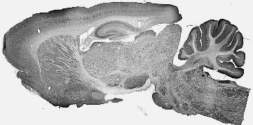 JIP-2/IB-2 Antibody in Immunohistochemistry (Frozen) (IHC (F))