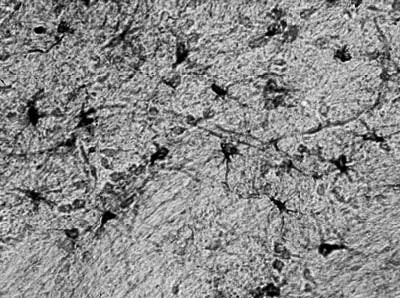 Aldh1L1 Antibody in Immunohistochemistry (Frozen) (IHC (F))