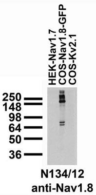 Nav1.8 Na+ Channel Antibody in Western Blot (WB)