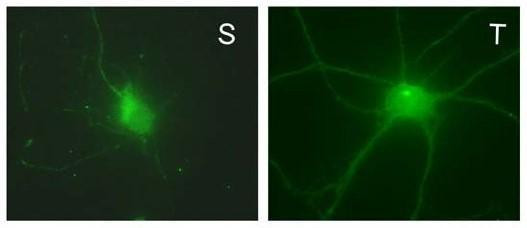GABA-A-R/Delta Antibody in Immunocytochemistry (ICC/IF)