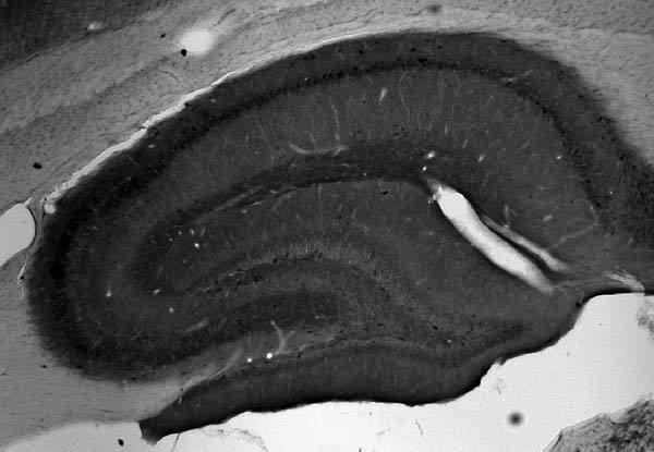 Mitofusin-2 Antibody in Immunohistochemistry (Frozen) (IHC (F))