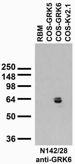 GRK6A/B Antibody in Western Blot (WB)