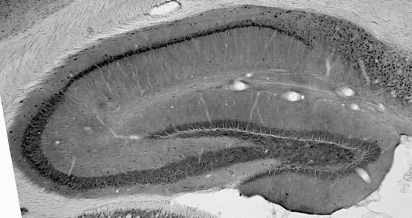 Botch Antibody in Immunohistochemistry (Frozen) (IHC (F))