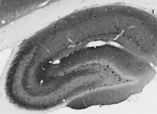 GABA-B-R1 Antibody in Immunohistochemistry (Frozen) (IHC (F))