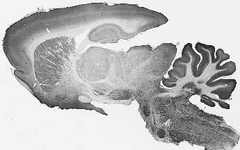 SynDIG3/Tmem91 Antibody in Immunohistochemistry (Frozen) (IHC (F))