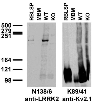 LRRK2/Dardarin Antibody in Western Blot (WB)