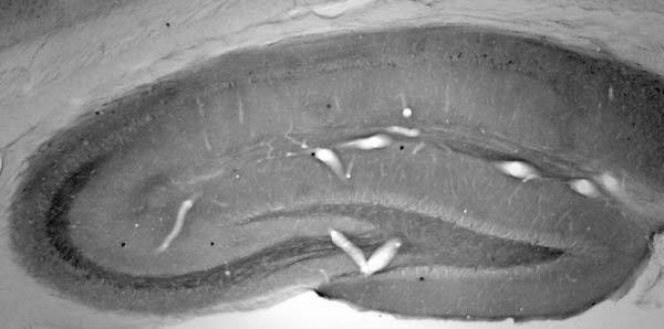 SALM5/LRFN5 Antibody in Immunohistochemistry (Frozen) (IHC (F))
