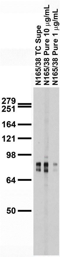 LAR/PTPRF (Receptor-Type Tyrosine-Protein Phosphatase) Antibody in Western Blot (WB)