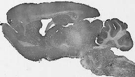 PARIS/ZNF746 Antibody in Immunohistochemistry (Frozen) (IHC (F))