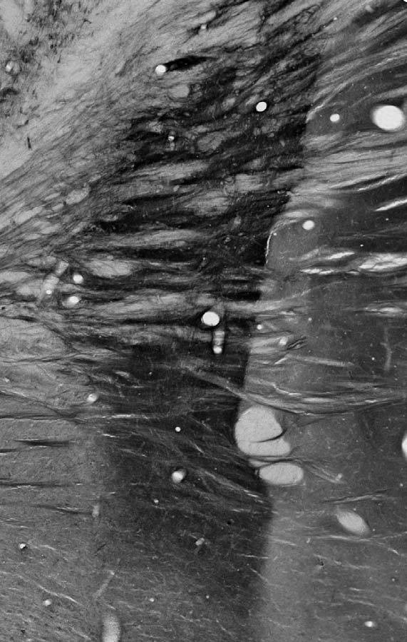 Navbeta4 Na+ Channel Antibody in Immunohistochemistry (Frozen) (IHC (F))