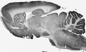 Fig4/Sac3 Antibody in Immunohistochemistry (Frozen) (IHC (F))