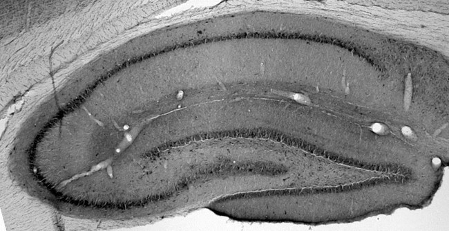 VDAC1 Antibody in Immunohistochemistry (Frozen) (IHC (F))
