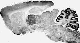 Cav3.1 Ca2+ Channel Antibody in Immunohistochemistry (Frozen) (IHC (F))