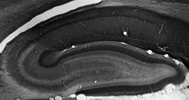 TRIP8b (Exon 4) Antibody in Immunohistochemistry (Frozen) (IHC (F))