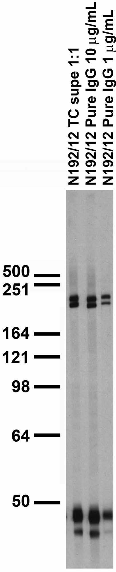 Gs Protein/Alpha Subunit Antibody in Western Blot (WB)