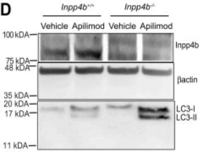 INPP4b Antibody in Western Blot (WB)