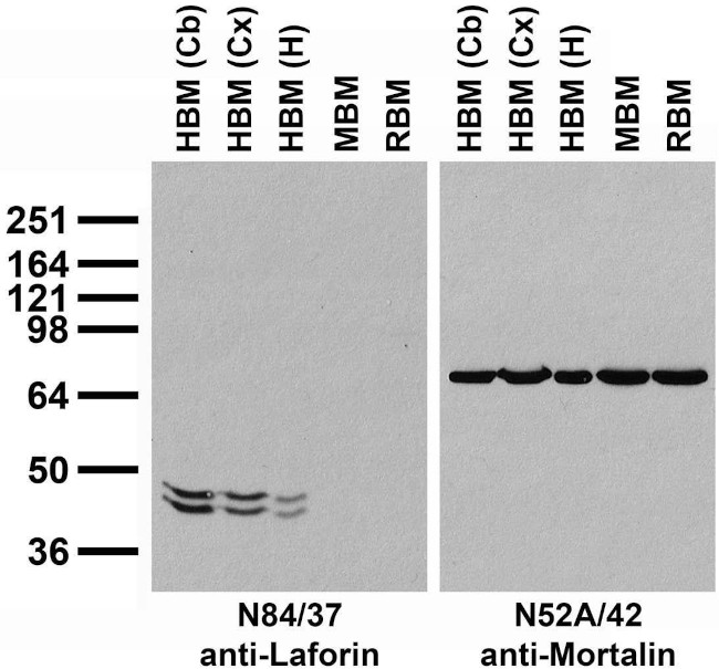 Laforin Antibody in Western Blot (WB)
