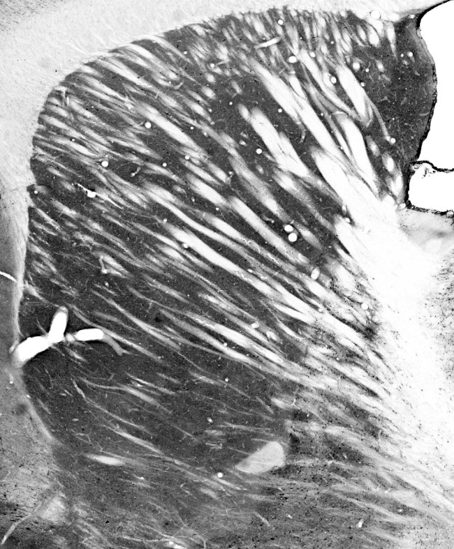 Dopamine D2 Receptor Antibody in Immunohistochemistry (Frozen) (IHC (F))