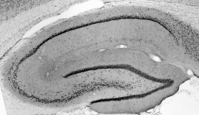 RBM17/SPF45 Antibody in Immunohistochemistry (Frozen) (IHC (F))