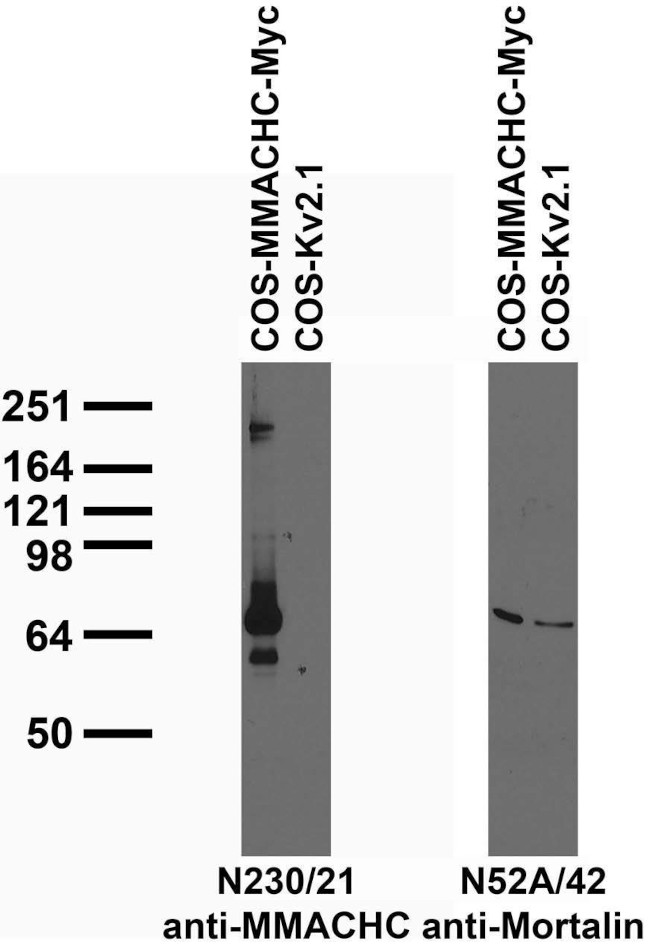 MMACHC Antibody in Western Blot (WB)