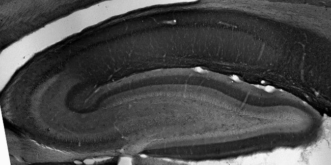 TRIP8b Antibody in Immunohistochemistry (Frozen) (IHC (F))