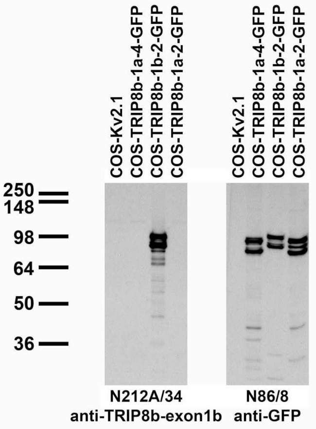 TRIP8b (Exon 1b) Antibody in Western Blot (WB)