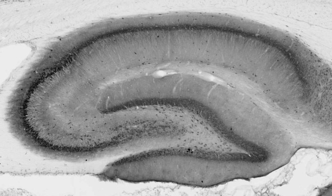 Pan-FHF-A Antibody in Immunohistochemistry (Frozen) (IHC (F))