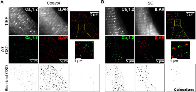 Cav1.2 Ca2+ Channel Antibody in Immunocytochemistry (ICC/IF)