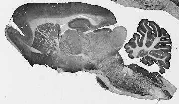Clcn3 Antibody in Immunohistochemistry (Frozen) (IHC (F))