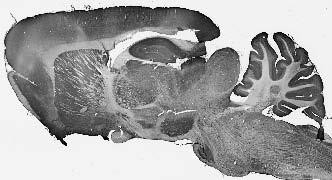 Clcn4 Antibody in Immunohistochemistry (Frozen) (IHC (F))