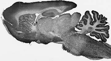 BBS3/Arl6 Antibody in Immunohistochemistry (Frozen) (IHC (F))