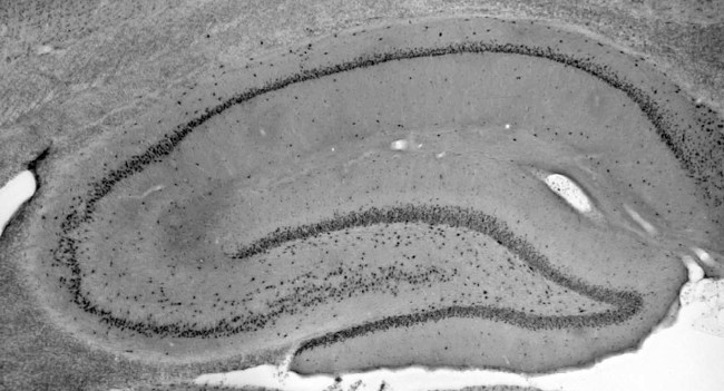 MECP2 Antibody in Immunohistochemistry (Frozen) (IHC (F))