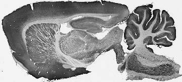 ASIC1 Antibody in Immunohistochemistry (Frozen) (IHC (F))