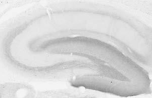 Kirrel3 Short Isoform 3 Antibody in Immunohistochemistry (Frozen) (IHC (F))