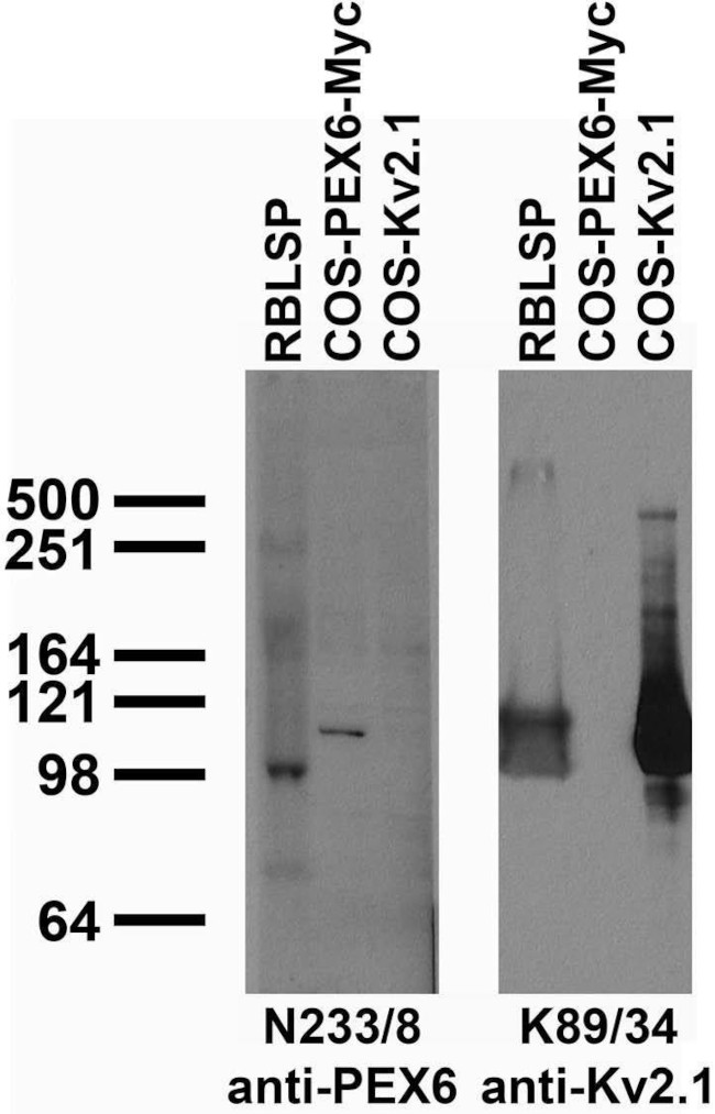 PEX6 Antibody in Western Blot (WB)