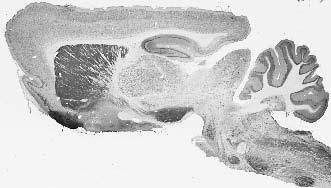 Rem2 Antibody in Immunohistochemistry (Frozen) (IHC (F))