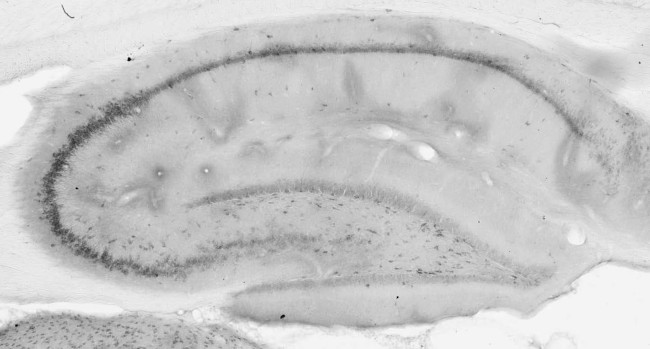 Lgi1 Antibody in Immunohistochemistry (Frozen) (IHC (F))