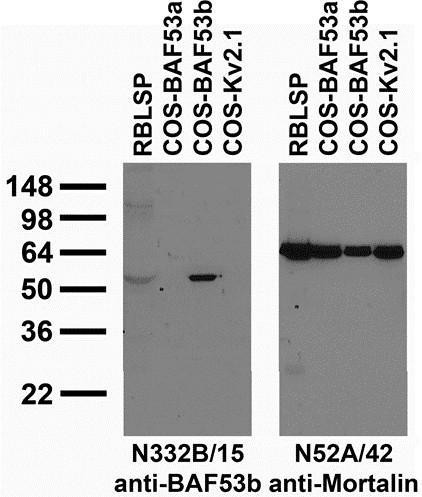 BAF53b Antibody in Western Blot (WB)