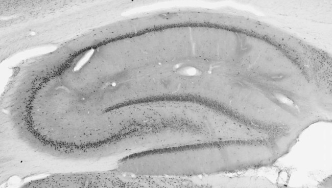 BAF53b Antibody in Immunohistochemistry (IHC)