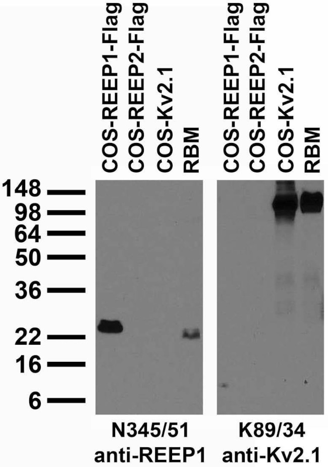 REEP1 Antibody in Immunohistochemistry (Frozen) (IHC (F))