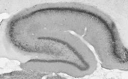 Kv2.1 Potassium Channel Subunit Antibody in Immunohistochemistry (IHC)