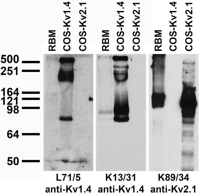 Kv1.4 Potassium Channel (Extracellular) Antibody in Western Blot (WB)