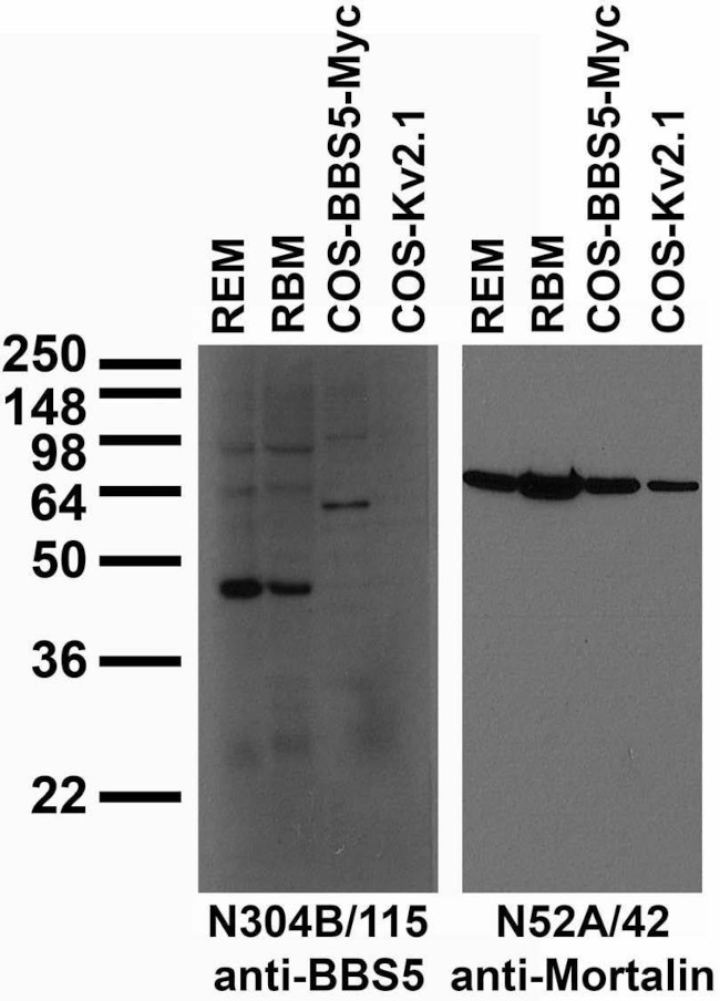 BBS5 Antibody in Dot Blot (DB)