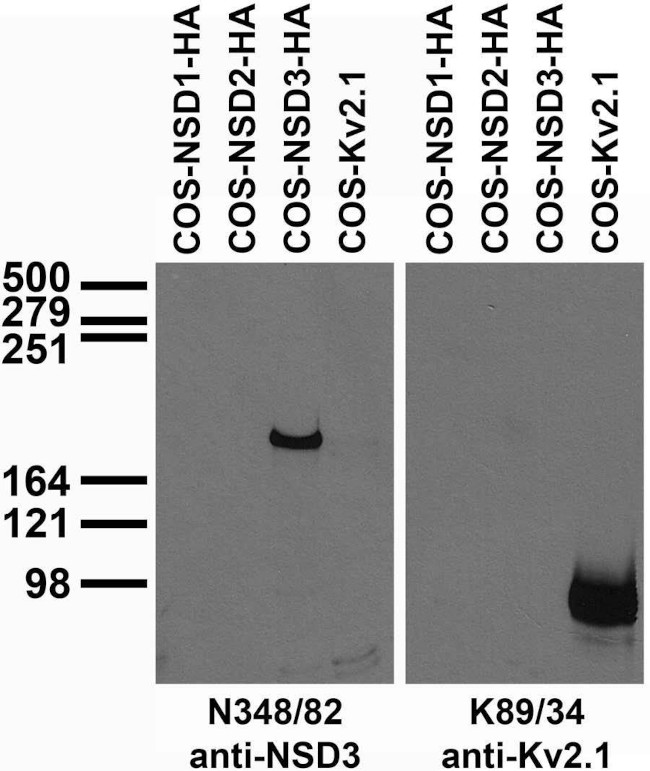 NSD3 Antibody in Immunocytochemistry (ICC/IF)