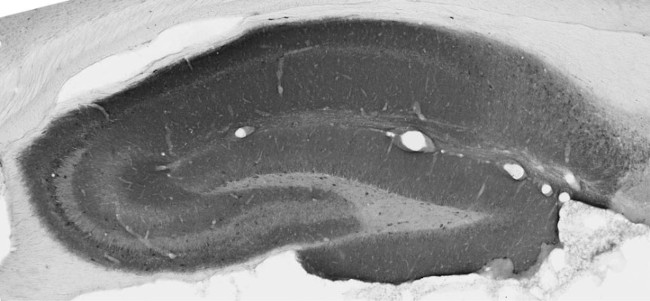 GluA1/GluR1 Glutamate Receptor Antibody in Immunocytochemistry (ICC/IF)