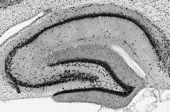 Shank3 Antibody in Immunohistochemistry (IHC)