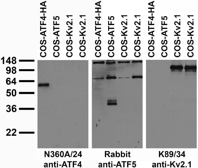 ATF4 Antibody in Immunocytochemistry (ICC/IF)